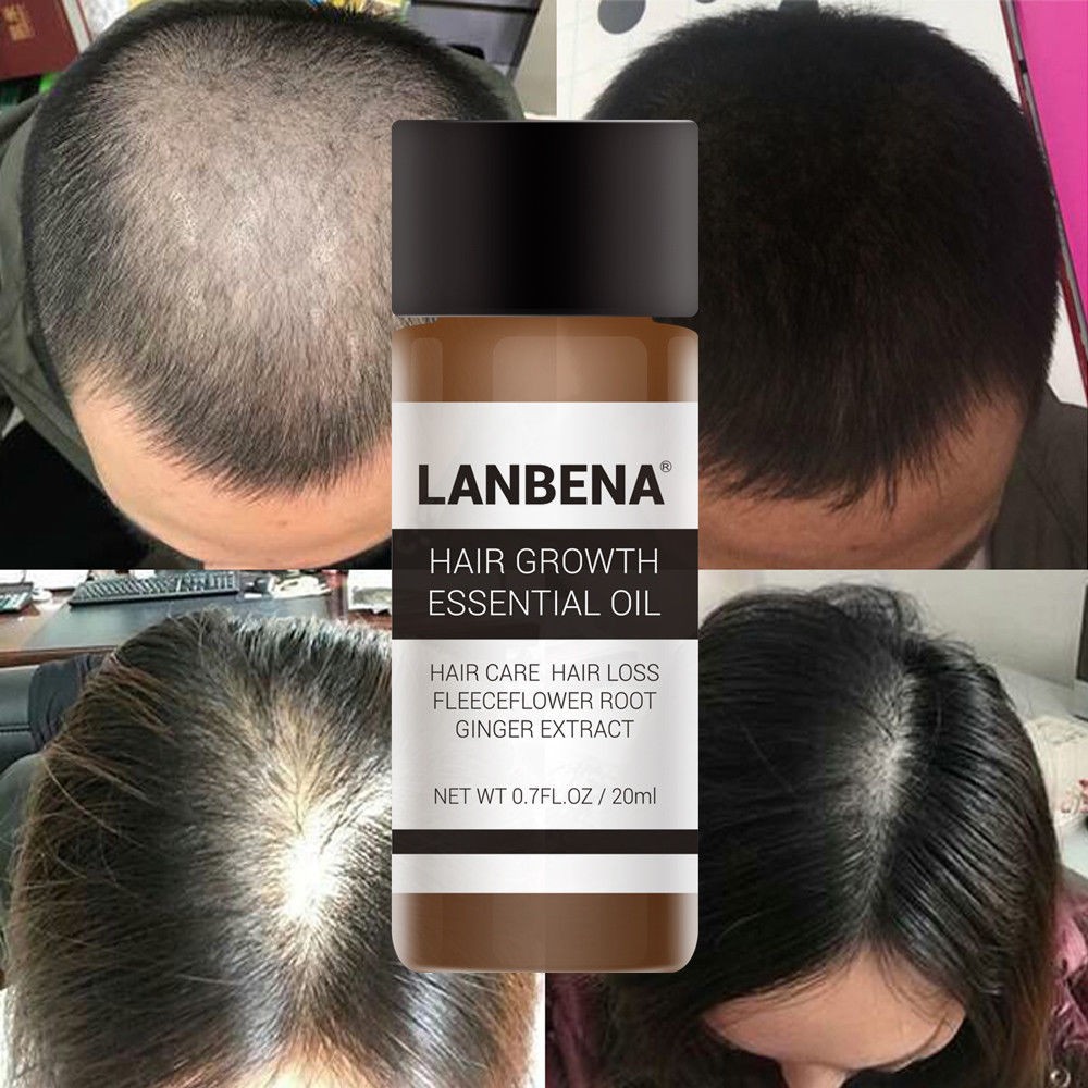 Lanbena Powerful Oil Faster Grow Hair Natural Anti Hair Loss Tonic Growing Shampoo Hair Care Treatment