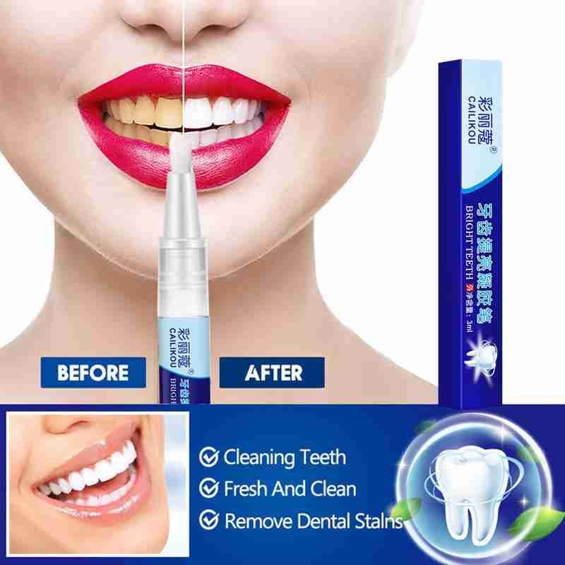 Teeth whitening pen professional teeth whitener and stain remover travel friendly effective teeth whitening